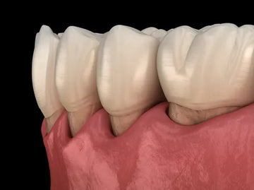 Can Gum Recession Be Reversed?